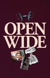Open Wide